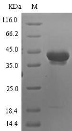 Recombinant Human Neurotrypsin(PRSS12) ,partial