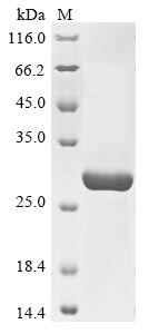 Recombinant Human Neutral ceramidase(ASAH2),partial