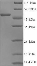 Recombinant Human Neutrophil elastase(ELANE)