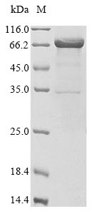 Recombinant Human Neutrophil elastase(ELANE),Biotinylated