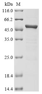 Recombinant Human Novel Coronavirus Nucleoprotein(N)(D63G,R203M,D377Y) (Active)
