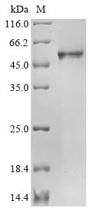Recombinant Human Novel Coronavirus Nucleoprotein(N)(R203K,G204R) (Active)