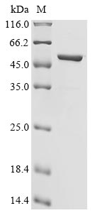 Recombinant Human Novel Coronavirus Nucleoprotein(N)(R203M,D377Y) (Active)