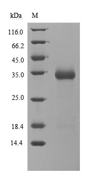 Recombinant Human Novel Coronavirus Spike glycoprotein(S)(G476S),partial (Active)