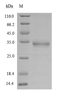 Recombinant Human Novel Coronavirus Spike glycoprotein(S)(V367F),partial (Active)