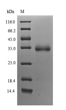 Recombinant Human Novel Coronavirus Spike glycoprotein(S)(V483A),partial (Active)