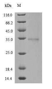 Recombinant Human Novel Coronavirus Spike glycoprotein(S)(W436R),partial (Active)