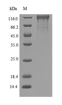 Recombinant Human Novel Coronavirus Spike glycoprotein(S) (D614G),partial (Active)