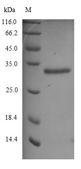 Recombinant Human Novel Coronavirus Spike glycoprotein(S) (N501Y),partial (Active)