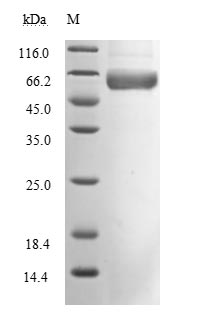 Recombinant Human Novel Coronavirus Spike glycoprotein(S), partial (Active)