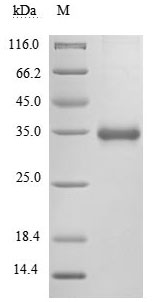 Recombinant Human Novel Coronavirus Spike glycoprotein(S),partial (Active)
