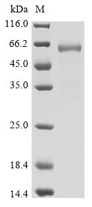 Recombinant Human Novel Coronavirus Spike glycoprotein(S),partial,Biotinylated (Active)