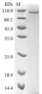 Recombinant Human Nuclear cap-binding protein subunit 1(NCBP1)