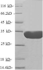 Recombinant Human Nuclear pore membrane glycoprotein 210(NUP210),partial