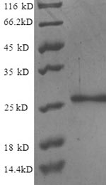 Recombinant Human Nuclear pore membrane glycoprotein 210(NUP210),partial