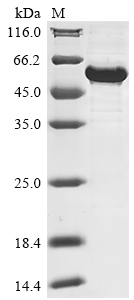 Recombinant Human Nuclear receptor ROR-alpha(RORA)