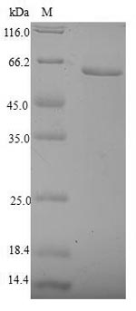 Recombinant Human Nuclear receptor subfamily 2 group F member 6(NR2F6)