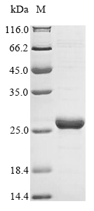 Recombinant Human O-acetyl-ADP-ribose deacetylase 1(OARD1)