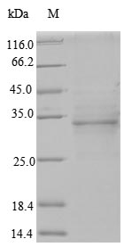 Recombinant Human Odontogenic ameloblast-associated protein(ODAM)