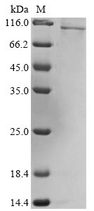 Recombinant Human Olfactomedin-like protein 2B(OLFML2B)