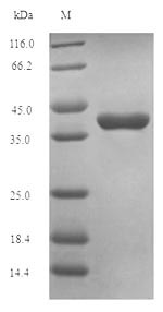 Recombinant Human Oncostatin-M(OSM)
