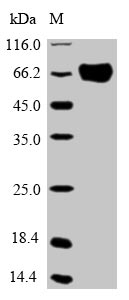 Recombinant Human Optineurin(OPTN)