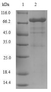 Recombinant Human Ornithine decarboxylase(ODC1)