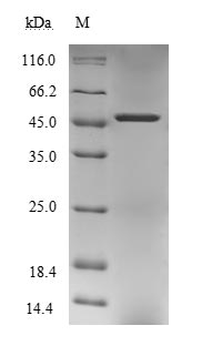 Recombinant Human Paraneoplastic antigen Ma1(PNMA1)