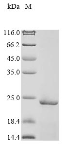 Recombinant Human Parathymosin(PTMS)