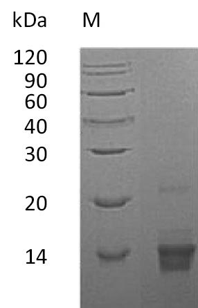 Recombinant Human Parathyroid hormone(PTH) (Active)