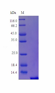 Recombinant Human Parathyroid hormone protein(PTH) (Active)