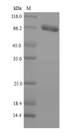 Recombinant Human Patatin-like phospholipase domain-containing protein 2(PNPLA2)
