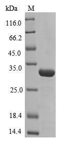 Recombinant Human Peroxiredoxin-1(PRDX1)