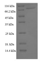 Recombinant Human Peroxisome proliferator-activated receptor gamma(PPARG)