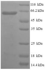 Recombinant Human Phosphatidylserine decarboxylase proenzyme, mitochondrial(PISD)