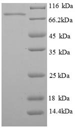 Recombinant Human Phosphoenolpyruvate carboxykinase, cytosolic [GTP](PCK1)