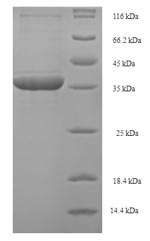 Recombinant Human Phospholysine phosphohistidine inorganic pyrophosphate phosphatase(LHPP)