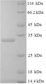 Recombinant Human Placenta growth factor(PGF)