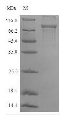 Recombinant Human Plastin-2(LCP1)