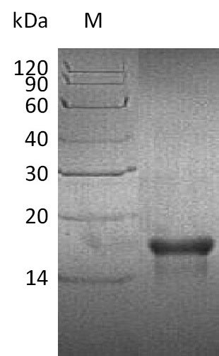 Recombinant Human Platelet-derived growth factor subunit A(PDGFA) (Active)