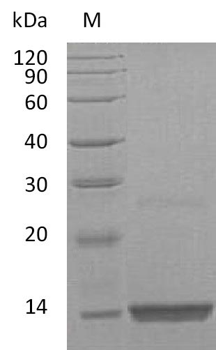 Recombinant Human Platelet-derived growth factor subunit B(PDGFB) (Active)