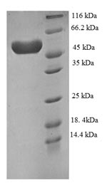 Recombinant Human Plexin-A4(PLXNA4),partial
