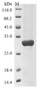 Recombinant Human Poly [ADP-ribose] polymerase 9(PARP9),partial