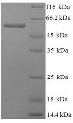 Recombinant Human Polyadenylate-binding protein 1(PABPC1),partial
