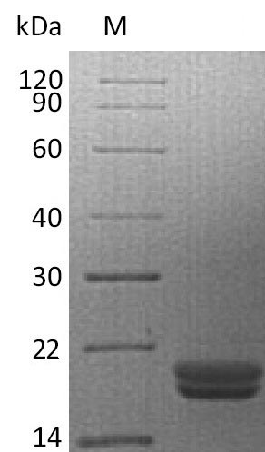 Recombinant Human Pro-interleukin-16(IL16) (Active)