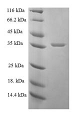 Recombinant Human Proactivator polypeptide(PSAP),partial