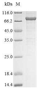 Recombinant Human Probable ATP-dependent RNA helicase DDX53(DDX53)