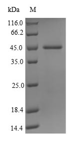 Recombinant Human Probable JmjC domain-containing histone demethylation protein 2C(JMJD1C),partial