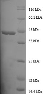 Recombinant Human Profilin-1(PFN1)