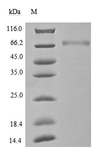 Recombinant Human Programmed cell death 1 ligand 1(CD274),partial (Active)